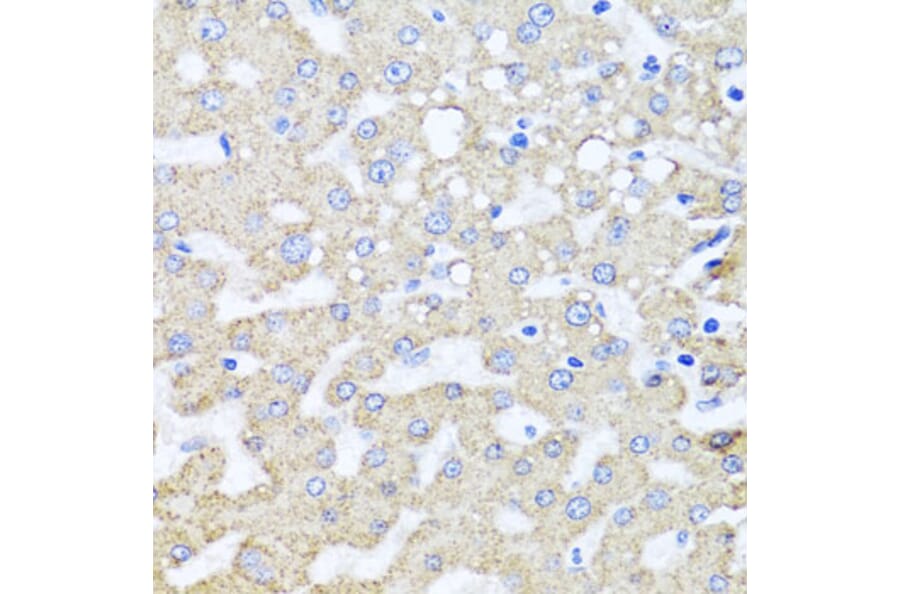 Immunohistochemistry - Anti-ARL6 Antibody (A16137) - Antibodies.com