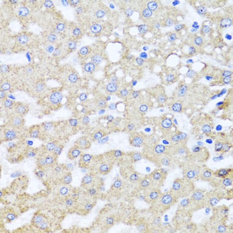 Immunohistochemistry - Anti-ARL6 Antibody (A16137) - Antibodies.com
