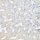 Immunohistochemistry - Anti-ARL6 Antibody (A16137) - Antibodies.com