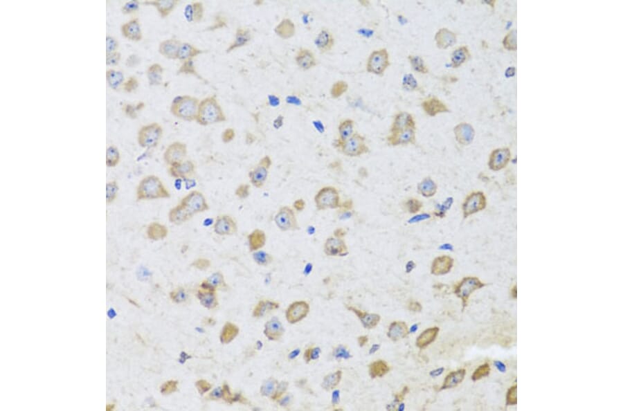 Immunohistochemistry - Anti-ARL6 Antibody (A16137) - Antibodies.com