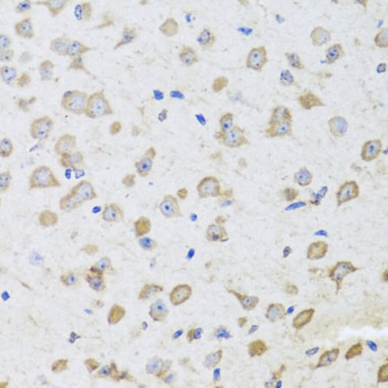 Immunohistochemistry - Anti-ARL6 Antibody (A16137) - Antibodies.com