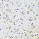 Immunohistochemistry - Anti-ARL6 Antibody (A16137) - Antibodies.com