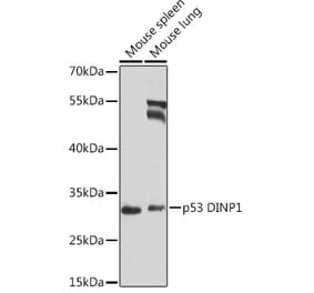 Western Blot - Anti-TP53INP1 Antibody (A16138) - Antibodies.com