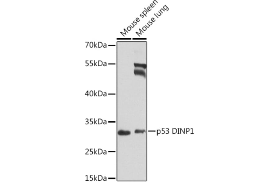 Western Blot - Anti-TP53INP1 Antibody (A16138) - Antibodies.com