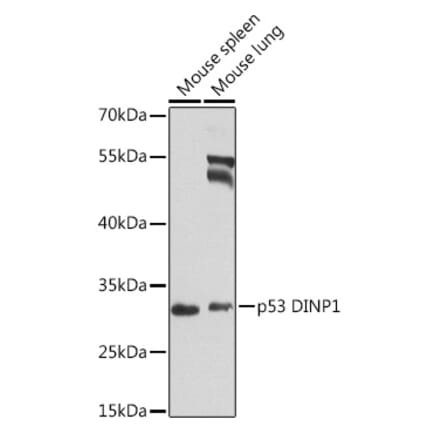 Western Blot - Anti-TP53INP1 Antibody (A16138) - Antibodies.com