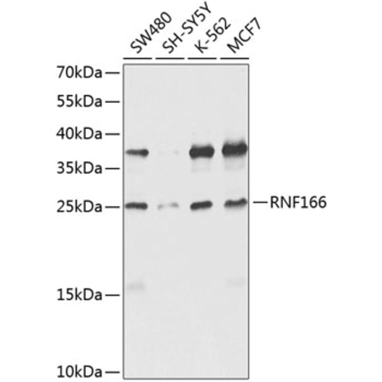 Western Blot - Anti-RNF166 Antibody (A16139) - Antibodies.com