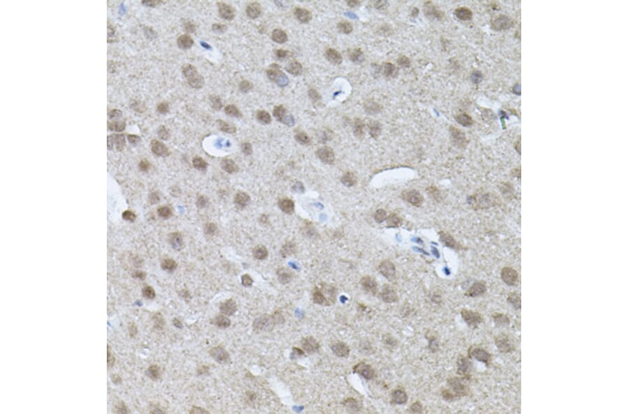 Immunohistochemistry - Anti-RNF166 Antibody (A16139) - Antibodies.com