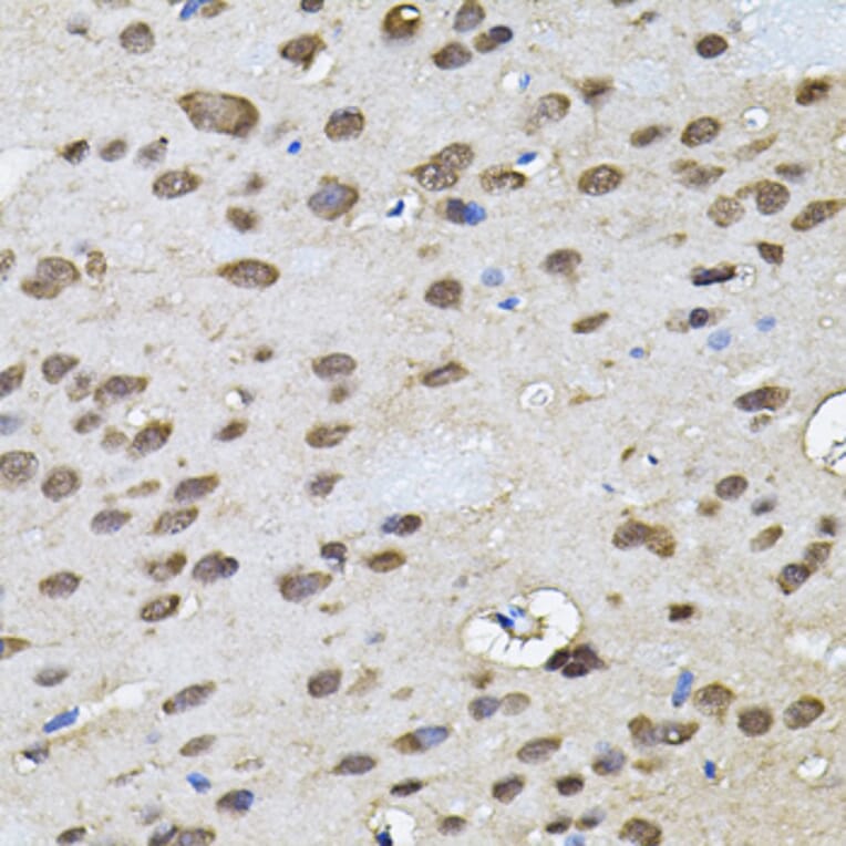 Immunohistochemistry - Anti-RNF166 Antibody (A16139) - Antibodies.com