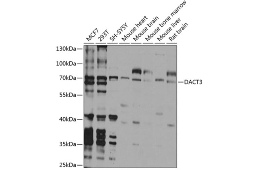 Western Blot - Anti-Dact3 Antibody (A16140) - Antibodies.com