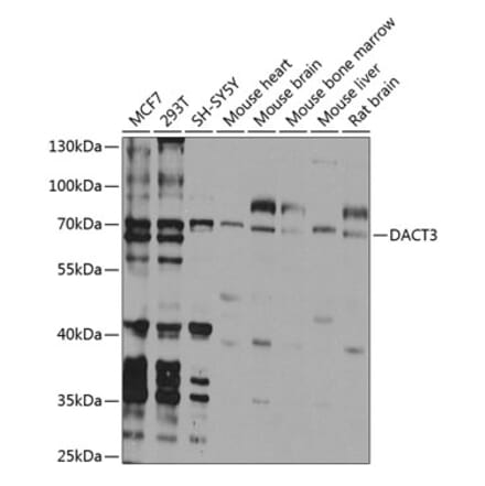 Western Blot - Anti-Dact3 Antibody (A16140) - Antibodies.com