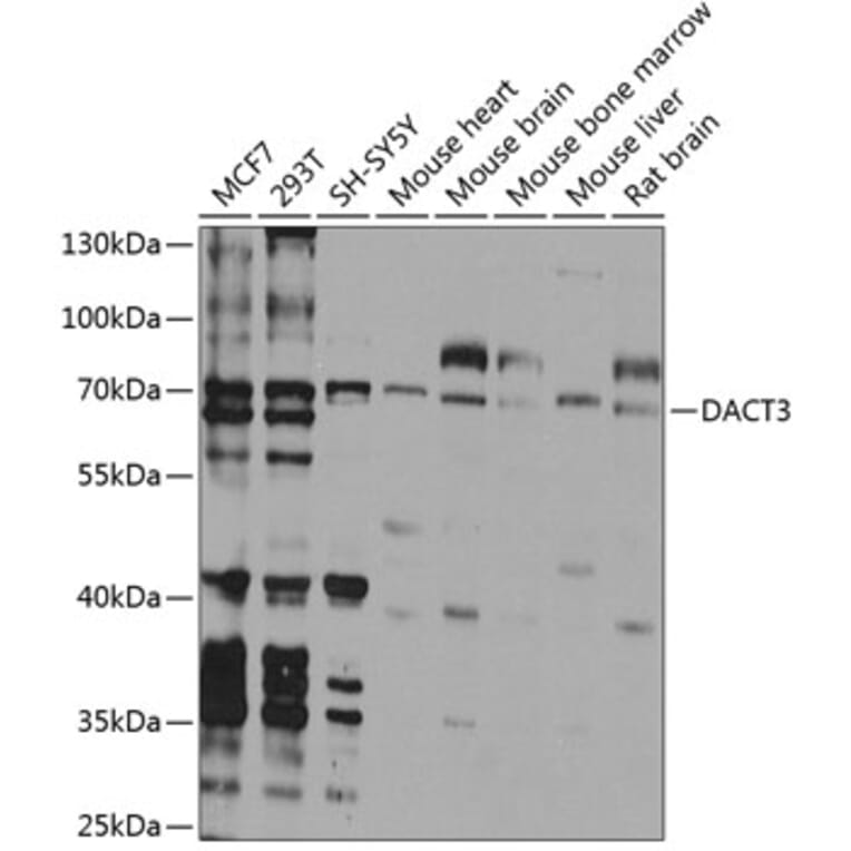 Western Blot - Anti-Dact3 Antibody (A16140) - Antibodies.com