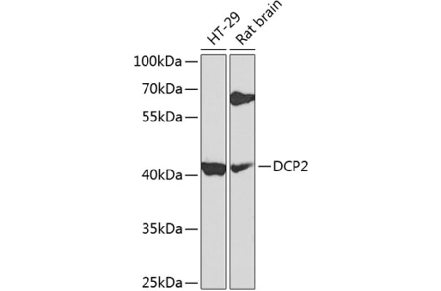 Western Blot - Anti-Dcp2/TDT Antibody (A16141) - Antibodies.com