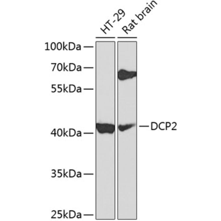 Western Blot - Anti-Dcp2/TDT Antibody (A16141) - Antibodies.com