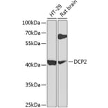 Western Blot - Anti-Dcp2/TDT Antibody (A16141) - Antibodies.com