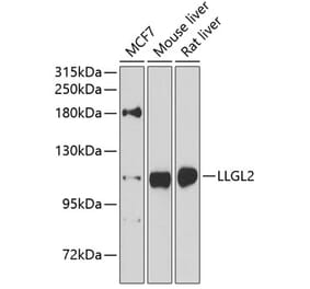 Western Blot - Anti-LLGL2 Antibody (A16142) - Antibodies.com