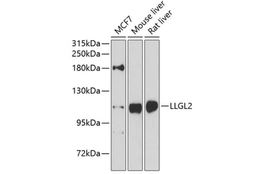 Western Blot - Anti-LLGL2 Antibody (A16142) - Antibodies.com