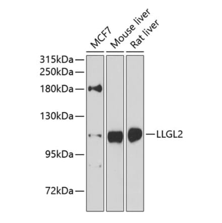 Western Blot - Anti-LLGL2 Antibody (A16142) - Antibodies.com