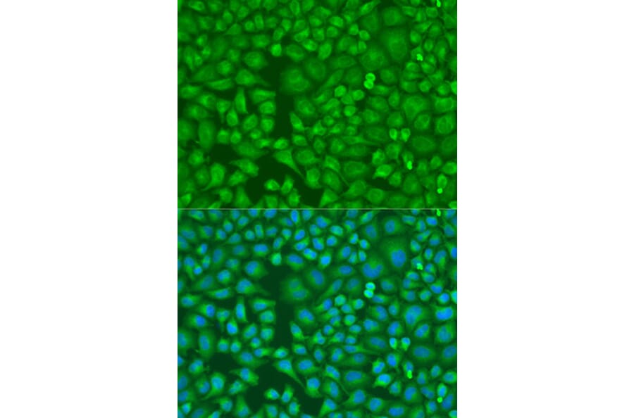 Immunofluorescence - Anti-LLGL2 Antibody (A16142) - Antibodies.com