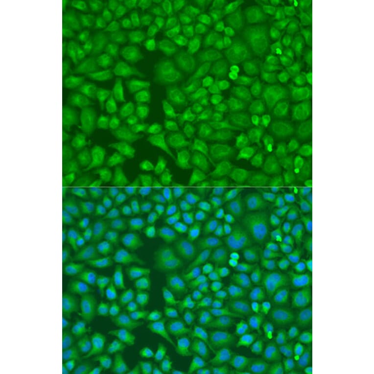 Immunofluorescence - Anti-LLGL2 Antibody (A16142) - Antibodies.com