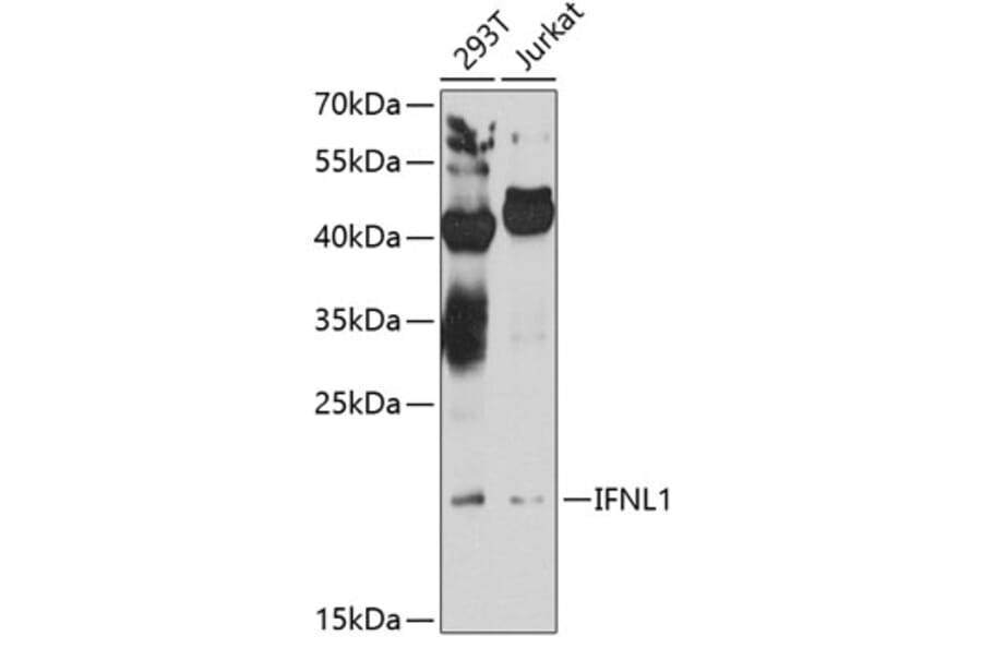 Western Blot - Anti-IL-29 Antibody (A16143) - Antibodies.com