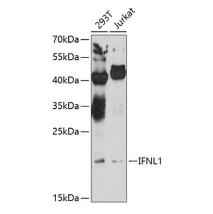 Western Blot - Anti-IL-29 Antibody (A16143) - Antibodies.com