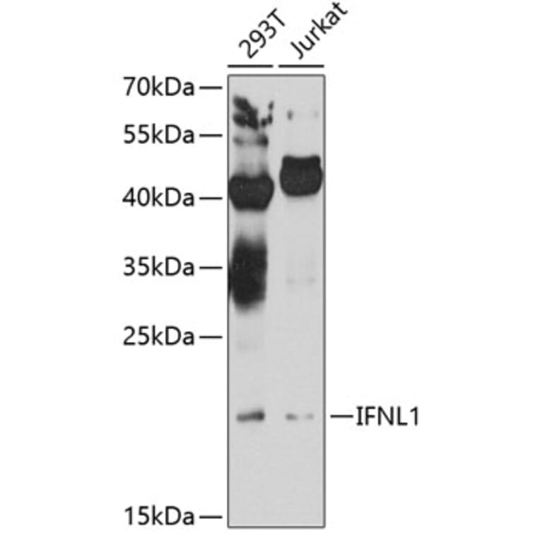 Western Blot - Anti-IL-29 Antibody (A16143) - Antibodies.com