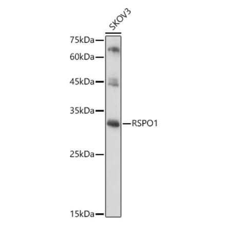 Western Blot - Anti-RSPO1 Antibody (A16144) - Antibodies.com