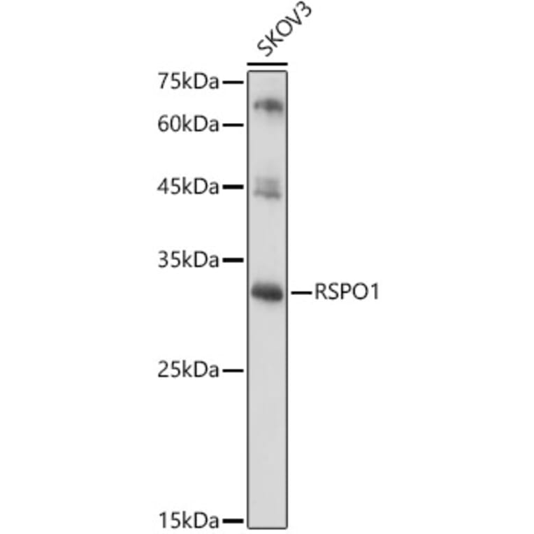 Western Blot - Anti-RSPO1 Antibody (A16144) - Antibodies.com