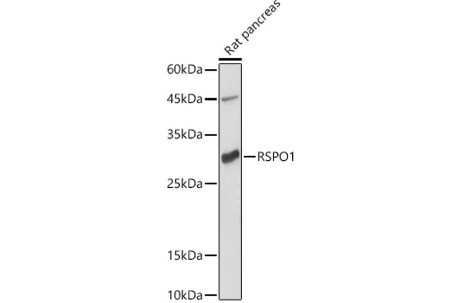Western Blot - Anti-RSPO1 Antibody (A16144) - Antibodies.com