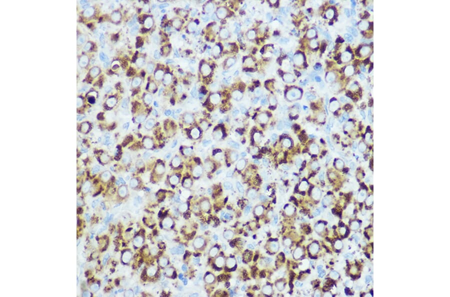 Immunohistochemistry - Anti-RSPO1 Antibody (A16144) - Antibodies.com