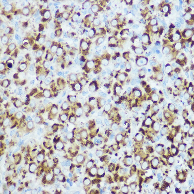 Immunohistochemistry - Anti-RSPO1 Antibody (A16144) - Antibodies.com