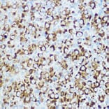 Immunohistochemistry - Anti-RSPO1 Antibody (A16144) - Antibodies.com