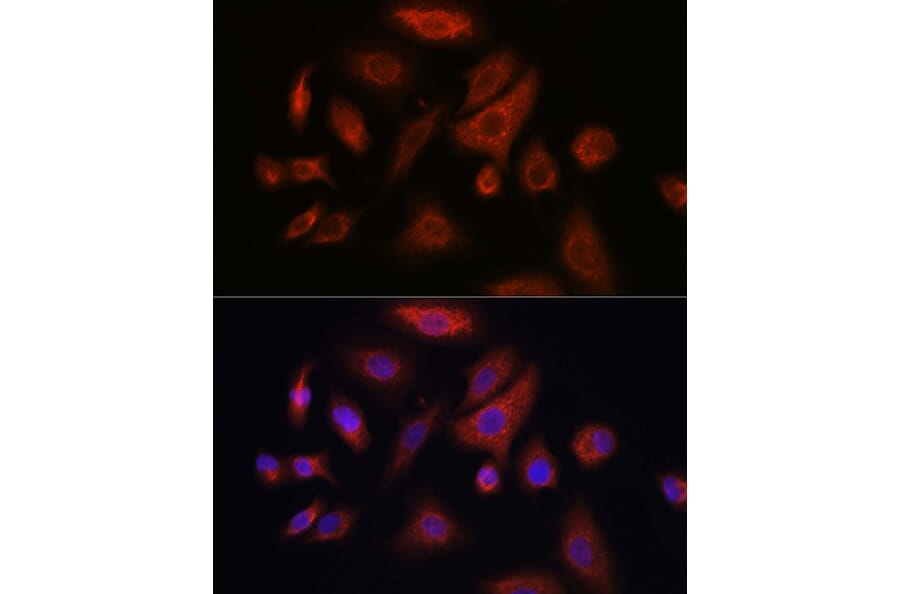 Immunofluorescence - Anti-RSPO1 Antibody (A16144) - Antibodies.com
