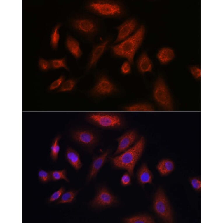 Immunofluorescence - Anti-RSPO1 Antibody (A16144) - Antibodies.com