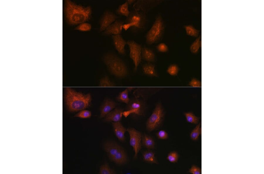 Immunofluorescence - Anti-RSPO1 Antibody (A16144) - Antibodies.com