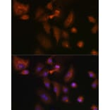 Immunofluorescence - Anti-RSPO1 Antibody (A16144) - Antibodies.com