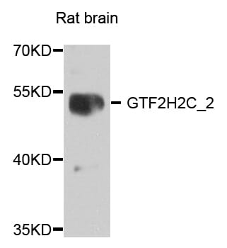Western blot analysis of extracts of rat brain, using Anti-GTF2H2C_2 Antibody (A8297) at 1:1,000 dilution.
Secondary antibody: Goat Anti-Rabbit IgG (H+L) (HRP) (AS014) at 1:10,000 dilution.
Lysates / proteins: 25µg per lane.
Blocking buffer: 3% non-fat dry milk in TBST.
Detection: ECL Enhanced Kit (RM00021).
Exposure time: 90s.
