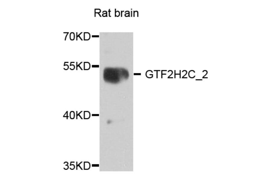 Western Blot - Anti-GTF2H2C_2 Antibody (A8297) - Antibodies.com