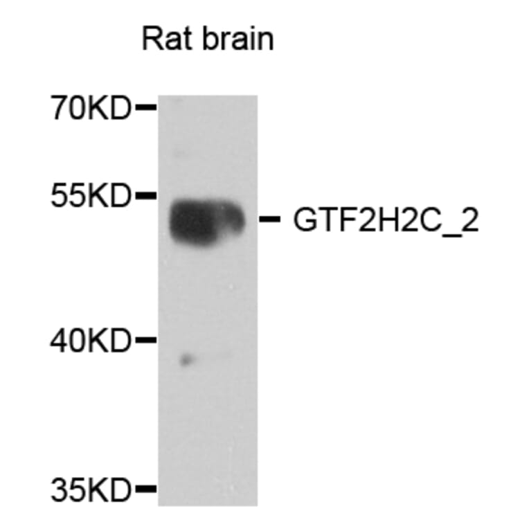 Western Blot - Anti-GTF2H2C_2 Antibody (A8297) - Antibodies.com