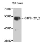Western Blot - Anti-GTF2H2C_2 Antibody (A8297) - Antibodies.com