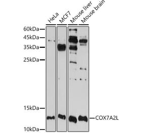 Western Blot - Anti-COX7A2L Antibody (A16146) - Antibodies.com