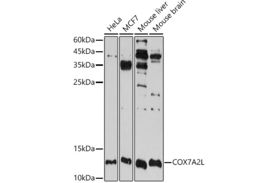 Western Blot - Anti-COX7A2L Antibody (A16146) - Antibodies.com