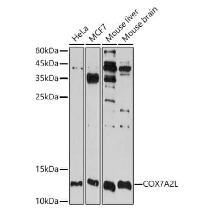 Western Blot - Anti-COX7A2L Antibody (A16146) - Antibodies.com