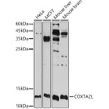 Western Blot - Anti-COX7A2L Antibody (A16146) - Antibodies.com
