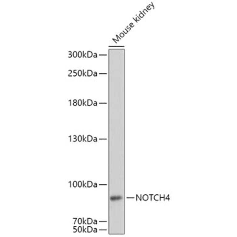 Western Blot - Anti-NOTCH4 Antibody (A16148) - Antibodies.com