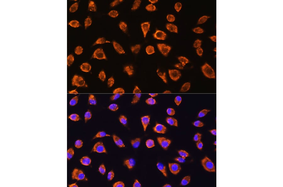 Immunofluorescence - Anti-NOTCH4 Antibody (A16148) - Antibodies.com
