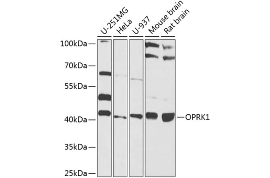 Western Blot - Anti-Kappa Opioid Receptor Antibody (A16150) - Antibodies.com