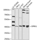 Western Blot - Anti-Kappa Opioid Receptor Antibody (A16150) - Antibodies.com