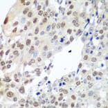 Immunohistochemistry - Anti-Securin Antibody (A16151) - Antibodies.com