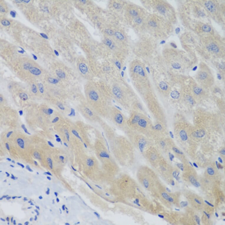 Immunohistochemistry - Anti-Securin Antibody (A16151) - Antibodies.com